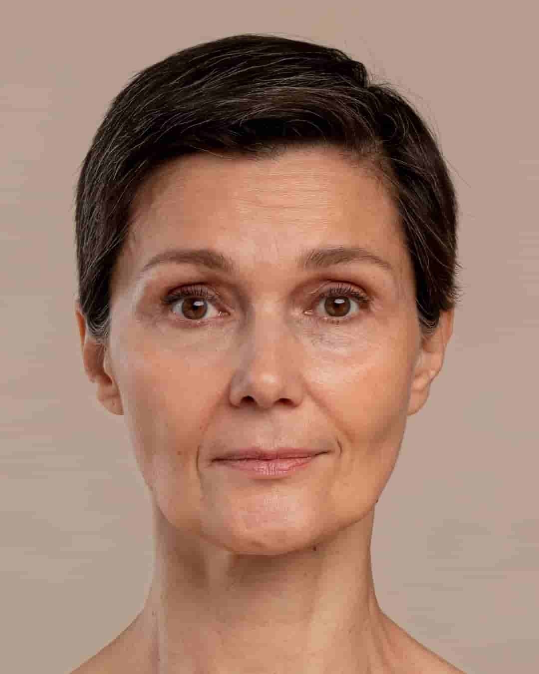 Berina-2 Berina-2